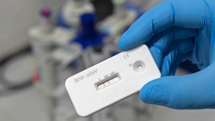 Три семейни огнища на COVID-19 са установени в област Перник от началото на пандемията досега 