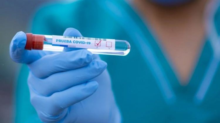 Първи вирусоносител на Covid-19 е карантиниран в Първомайско. Заразената не е болна