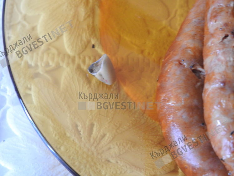 Зъбната коронка и карначетата