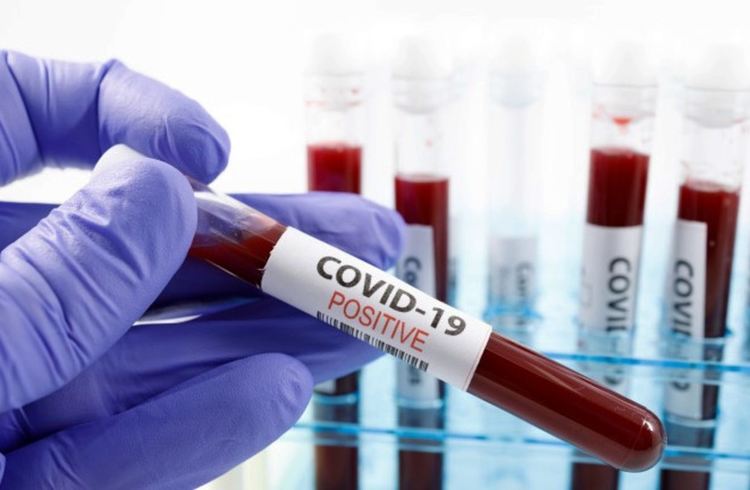 Мъж на 76 години от Димитровград е с коронавирус, изписват двама оздравели 