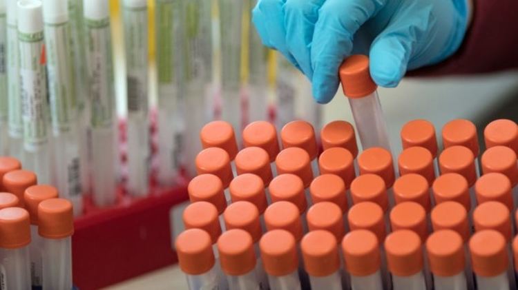 Два нови случая на заразени с КОВИД -19 са регистрирани в Първомай