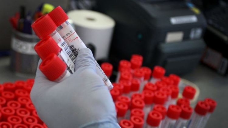 Мъж на 39 години от Искра, заразен с COVID-19, е приет в болница 