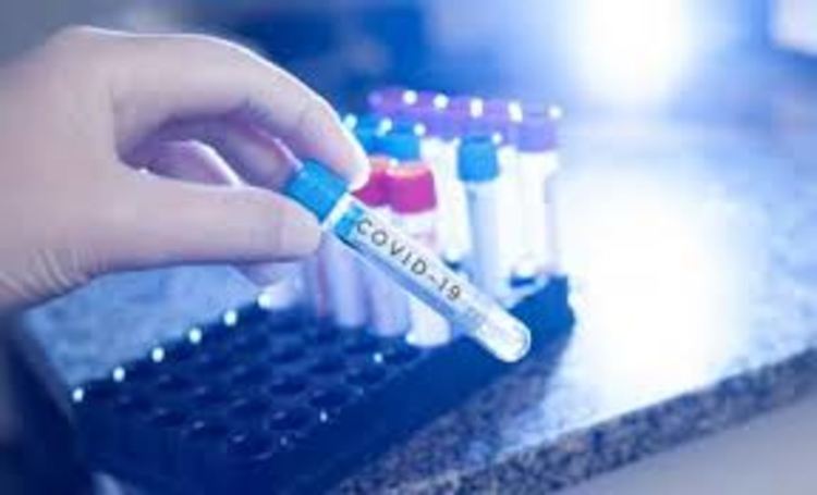 Двама  мъже загубиха битката с COVID -19