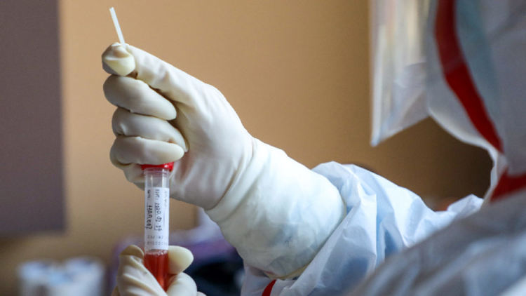 Лекар от болницата в Хасково  сред новозаразените 94 с коронавирус