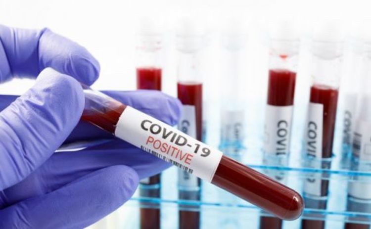 13 новозаразени с коронавирус от димитровградско