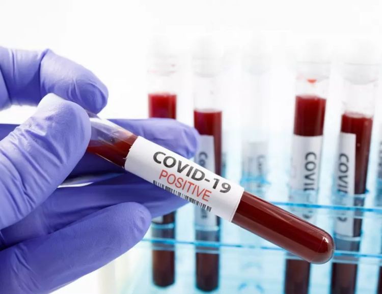 3 починали с коронавирус, 52 заразени и 7 излекувани в Хасковско