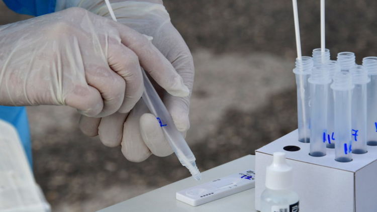 103 са излекувани за 24 часа, 23-ма новозаразени с коронавирус