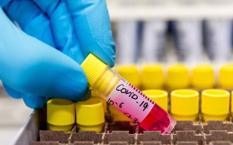 Двама починали и 18 заразени с коронавирус в Хасковско