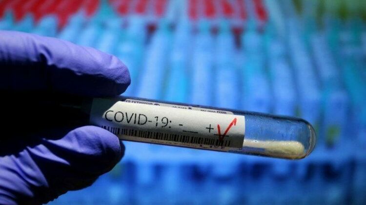 56 са новите случаи на COVID-19 в област Пловдив за последното денонощие 