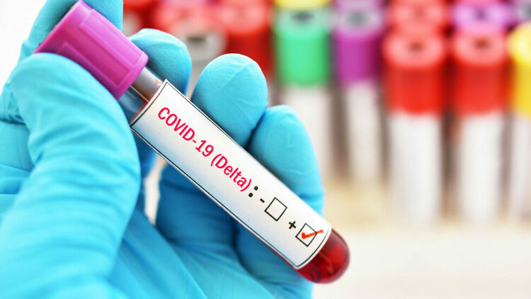 Три от четири проби в Хасково с „Делта“ мутацията на Ковид-19