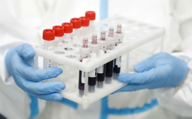 Четирима починали и 64 нови случая на коронавирус в Хасковско