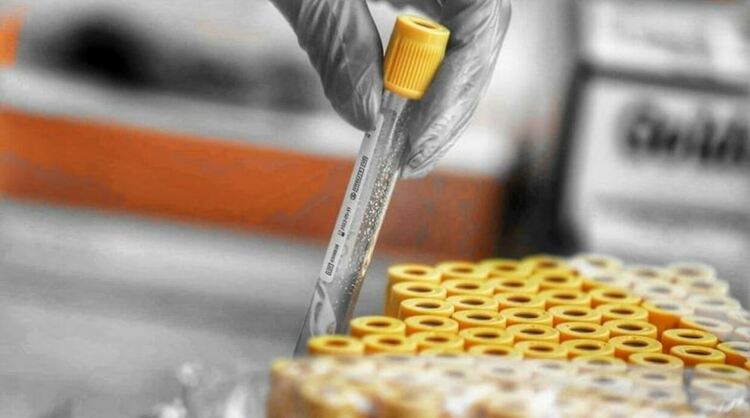 Разкриват още две COVID отделения в Перник