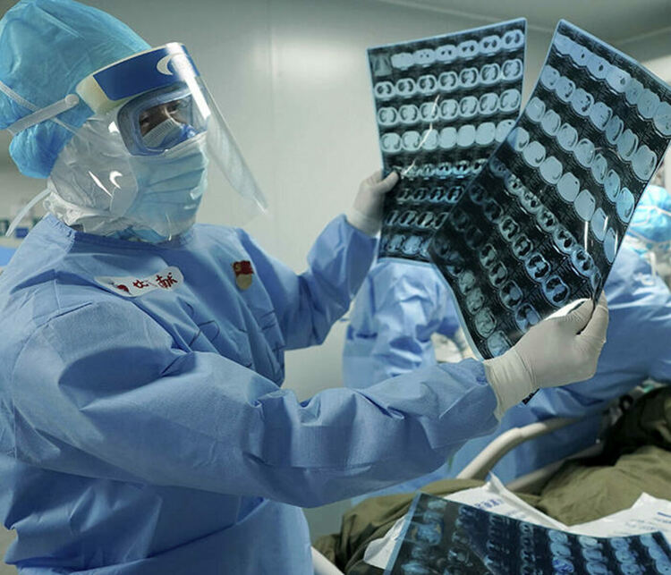 Европейски учени откриха как тежък COVID-19 поразява мозъка