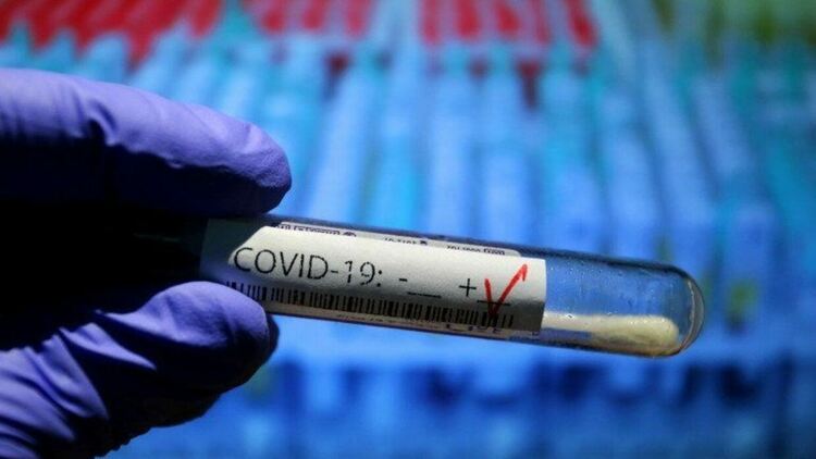 Официален доклад: Само 2,9% от смъртните случаи от COVID-19 в Италия се дължат на вируса