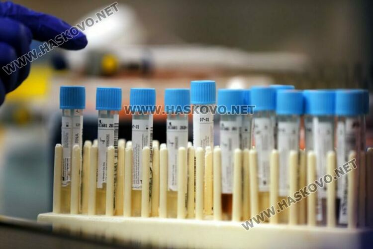 Добра новина: Драстичен спад в броя на новозаразените-79 за денонощие