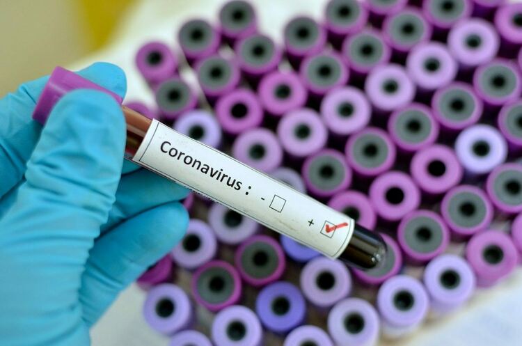 76 са интубираните пациенти с COVID-19 в област Пловдив 