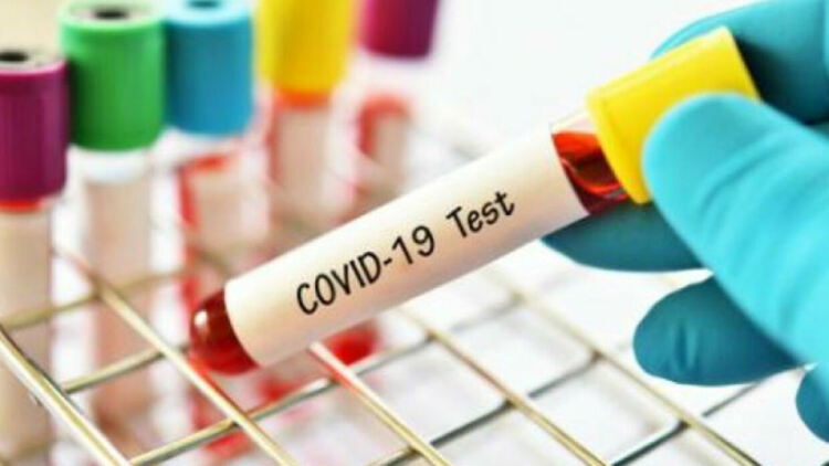 Двама починали с коронавирус и 89 заразени в Хасковско, сред които са учителки и ученик