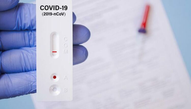 Безплатните бързи антигенни тестове, които осигуряваше здравното министерство, са свършили