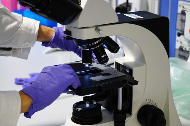 Не е открит хепатит с неизяснена етиология в пробата на детето от Бургас