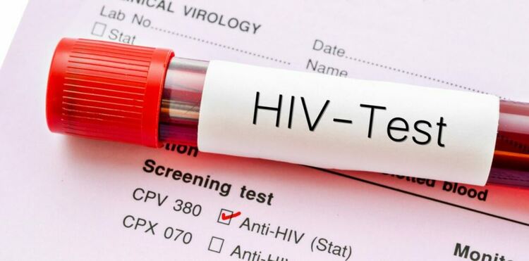 В РЗИ-Смолян тестват безплатно и анонимно за ХИВ 