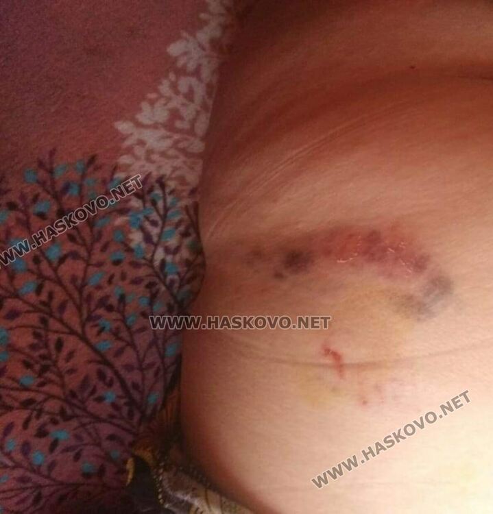 Хасковлийка е нападната от куче до Бизнес центъра тази сутрин