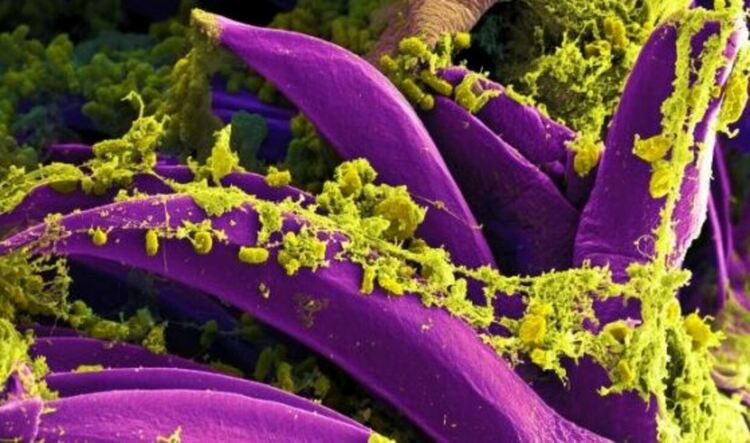 Сканираща електронна микрофотография на Yersinia pestis, която причинява бубонната чума, върху шипове на Xenopsylla cheopis (бълха). Кредит: NIAID, NIH