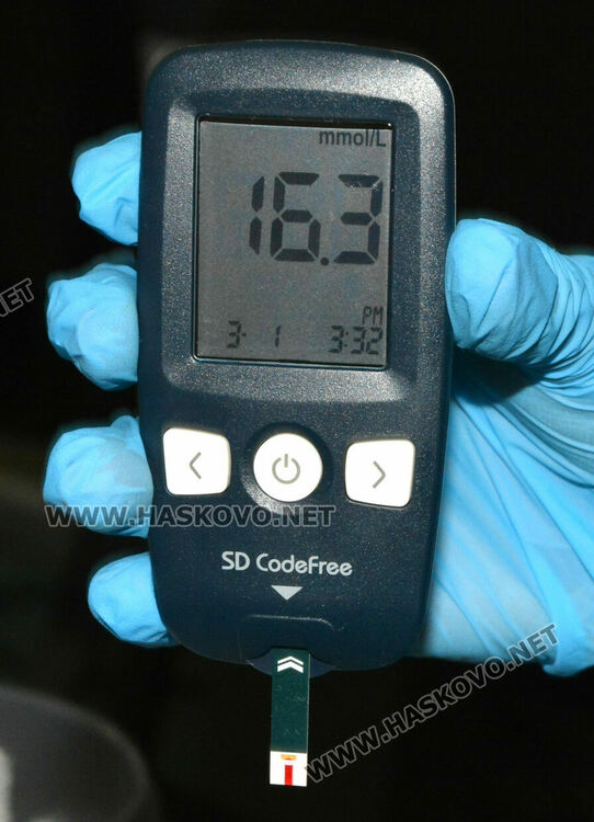 Д-р Балтаджиев: Диабетът е на трето място по значимост, придоби мащабите на пандемия