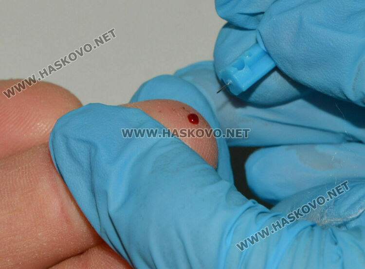 РЗИ-Хасково с превенция срещу диабет в училища и градини