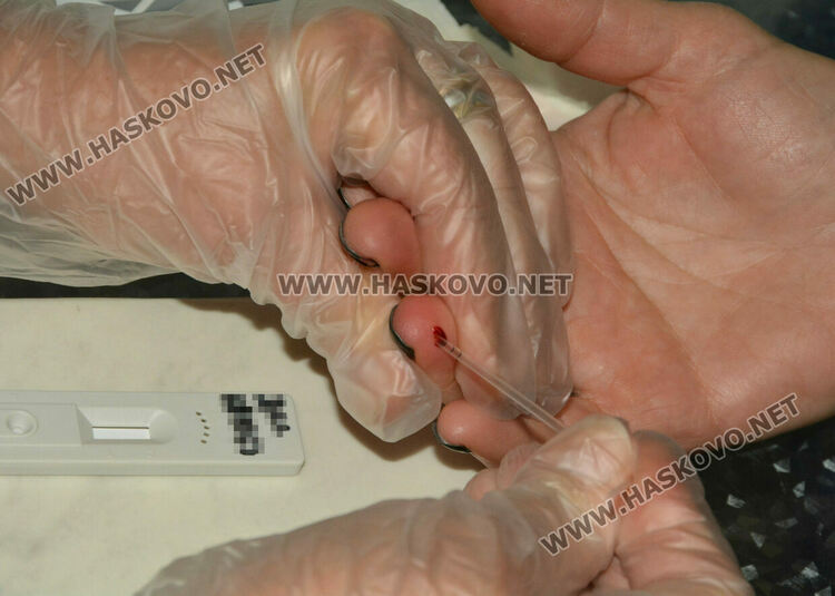 3-4 мъже са заразени със СПИН в Хасковско. Тестваха ученици и учители в ПМГ