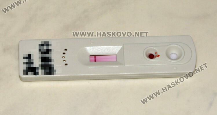 3-4 мъже са заразени със СПИН в Хасковско. Тестваха ученици и учители в ПМГ