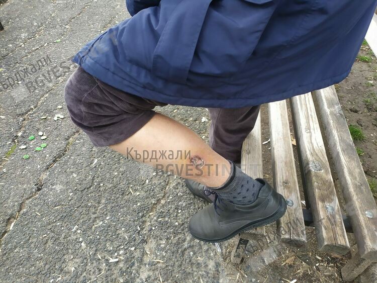 Бивш зам.-кмет на Пловдив съди Община Кърджали, заради нападение от бездомно куче