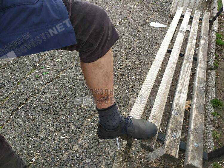 Бивш зам.-кмет на Пловдив съди Община Кърджали, заради нападение от бездомно куче