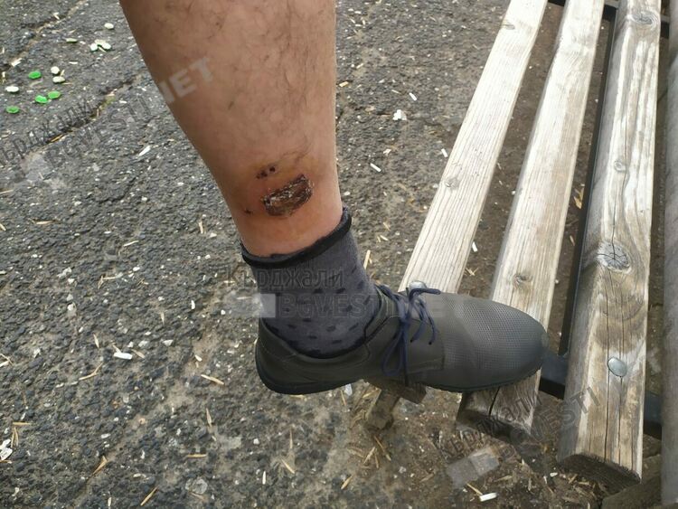 Бивш зам.-кмет на Пловдив съди Община Кърджали, заради нападение от бездомно куче