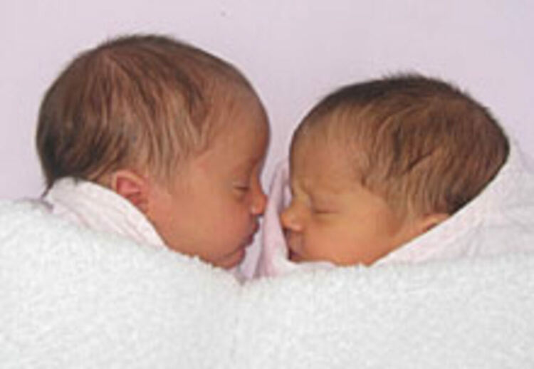 На 8 март в МБАЛ „Д-р Атанас Дафовски “ се родиха близнаци,през тази година са проплакали 80 бебета  