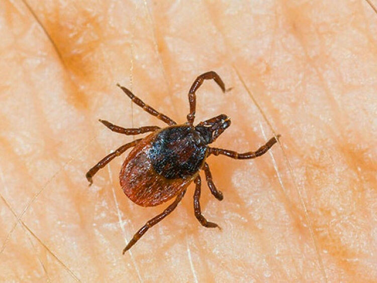 Първи за годината случай на лаймска болест в Хасково