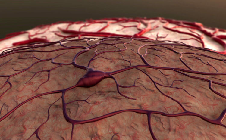 Създадоха капки за нос срещу последиците от инсулт