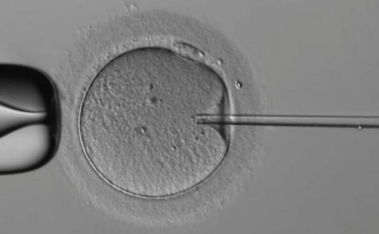 Кредит: Overture Life