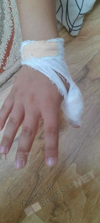 Дете на 6 години пострада на повредена от вандали пързалка в центъра на Кърджали/снимки/