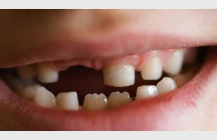 Шанс за зъбното здраве на децата от област Смолян –  започна кампанията по силанизация – 2023 г.