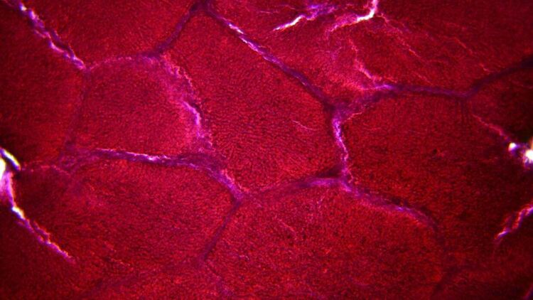 Черният дроб помага за предотвратяването на атеросклероза