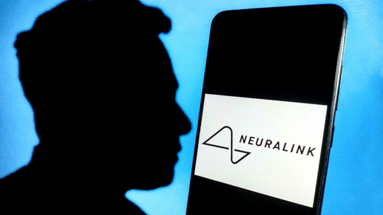 Neuralink показа Ноланд Арбо - първият човек с имплантиран чип Telepathy