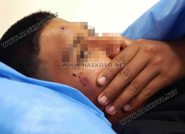 14-годишно момче е в болница след бой в училището в Узунджово 