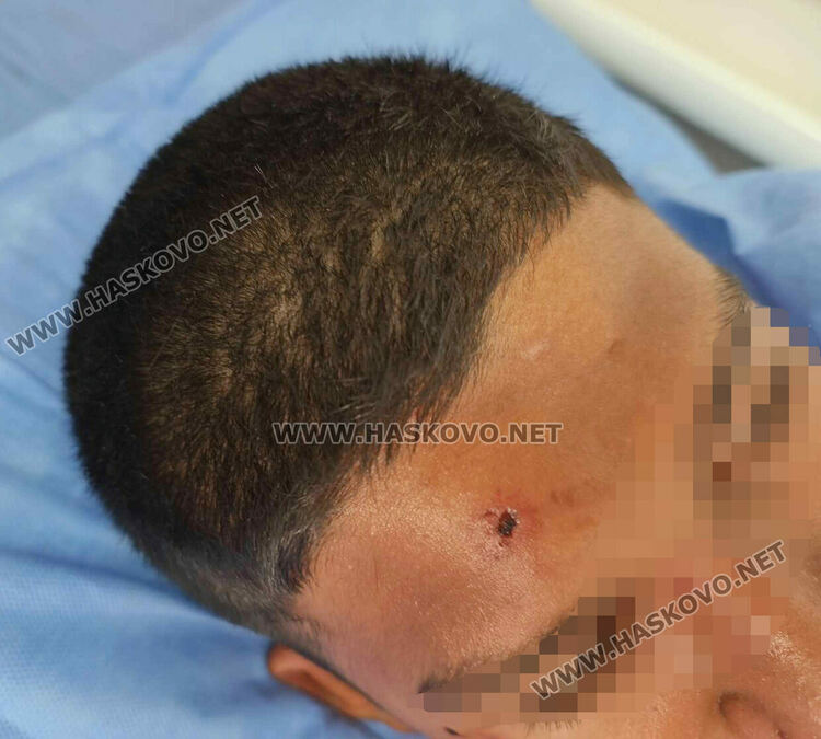 14-годишно момче е в болница след бой в училището в Узунджово 