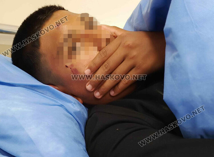 14-годишно момче е в болница след бой в училището в Узунджово 