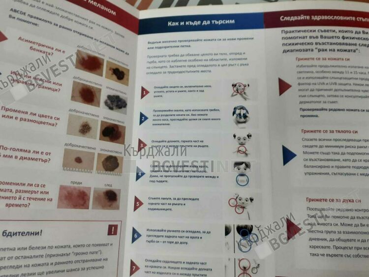 Безплатни прегледи за рак на кожата се проведоха в МБАЛ“Ат. Дафовски“