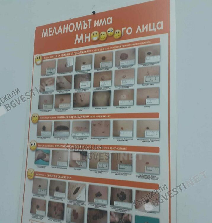 Безплатни прегледи за рак на кожата се проведоха в МБАЛ“Ат. Дафовски“
