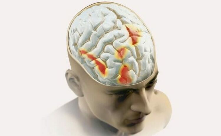 Чрез стимулиране на един от тези региони с електрически ток учените показаха, че могат да манипулират плацебо ефекта