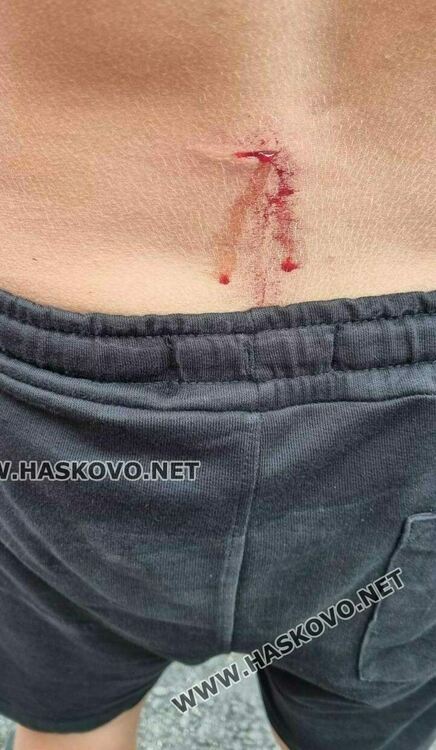 МВР: 13-годишното дете в Малево е одраскано от удар с джобно ножче, не е намушкано