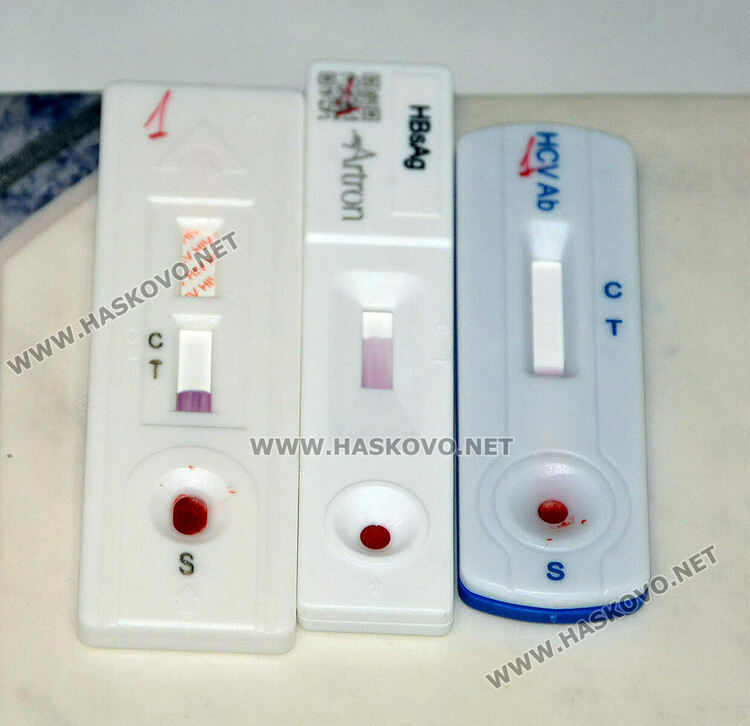 Безплатни изследвания за СПИН, регистрираха 10 нови случая в Хасковско