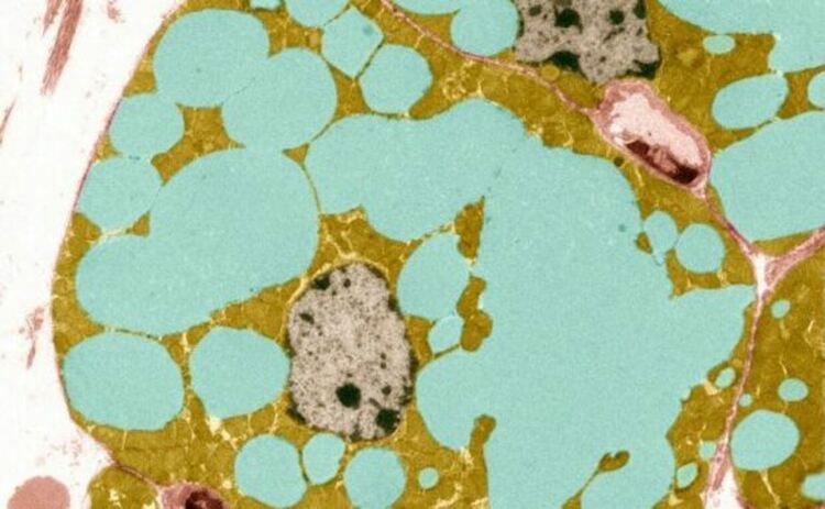 Мастната тъкан (изкуствено оцветена) се намалява чрез стриктно и продължително намаляване на калориите. Новоидентифицирана молекула имитира антиейджинг ефекта на тази диета.